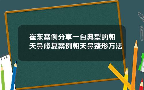 崔东案例分享一台典型的朝天鼻修复案例朝天鼻整形方法
