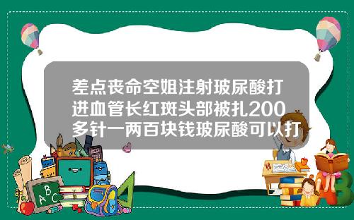 差点丧命空姐注射玻尿酸打进血管长红斑头部被扎200多针一两百块钱玻尿酸可以打吗