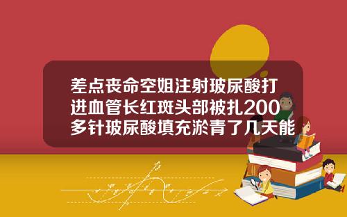 差点丧命空姐注射玻尿酸打进血管长红斑头部被扎200多针玻尿酸填充淤青了几天能好
