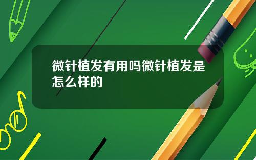 微针植发有用吗微针植发是怎么样的