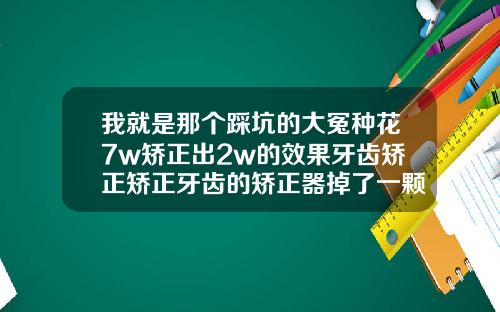 我就是那个踩坑的大冤种花7w矫正出2w的效果牙齿矫正矫正牙齿的矫正器掉了一颗有没有关系