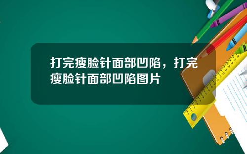 打完瘦脸针面部凹陷，打完瘦脸针面部凹陷图片