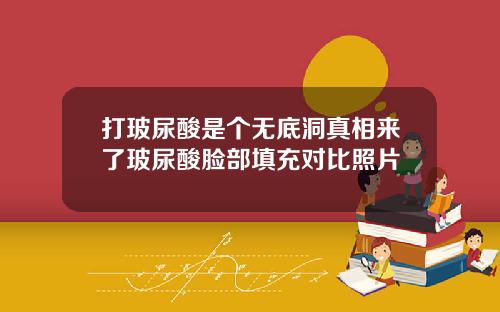 打玻尿酸是个无底洞真相来了玻尿酸脸部填充对比照片