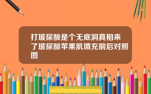 打玻尿酸是个无底洞真相来了玻尿酸苹果肌填充前后对照图