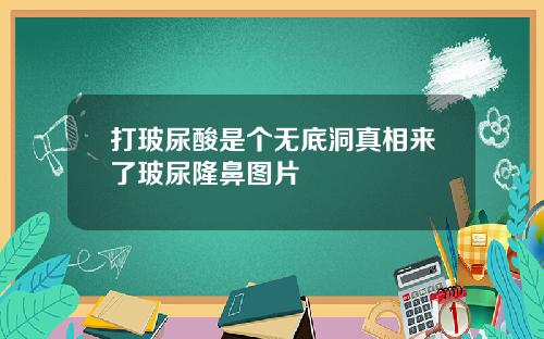 打玻尿酸是个无底洞真相来了玻尿隆鼻图片