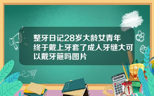 整牙日记28岁大龄女青年终于戴上牙套了成人牙缝大可以戴牙箍吗图片
