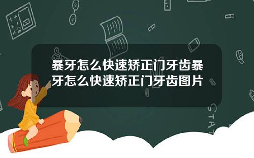 暴牙怎么快速矫正门牙齿暴牙怎么快速矫正门牙齿图片
