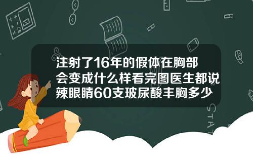 注射了16年的假体在胸部会变成什么样看完图医生都说辣眼睛60支玻尿酸丰胸多少钱
