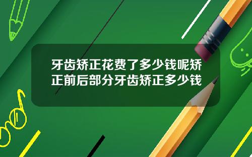 牙齿矫正花费了多少钱呢矫正前后部分牙齿矫正多少钱