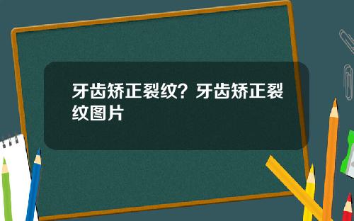 牙齿矫正裂纹？牙齿矫正裂纹图片