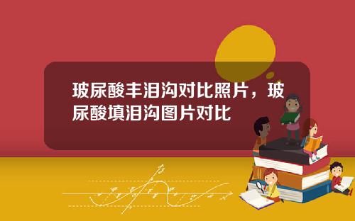 玻尿酸丰泪沟对比照片，玻尿酸填泪沟图片对比