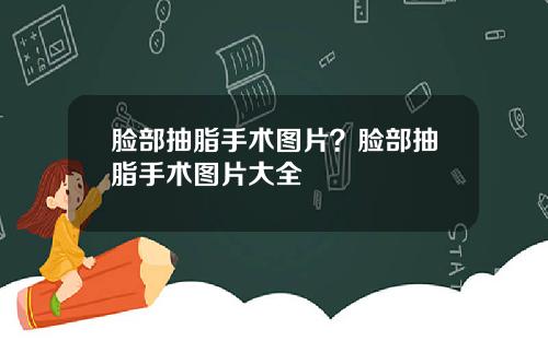 脸部抽脂手术图片？脸部抽脂手术图片大全