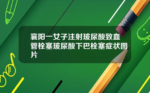 襄阳一女子注射玻尿酸致血管栓塞玻尿酸下巴栓塞症状图片