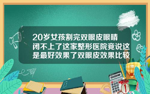 20岁女孩割完双眼皮眼睛闭不上了这家整形医院竟说这是最好效果了双眼皮效果比较好