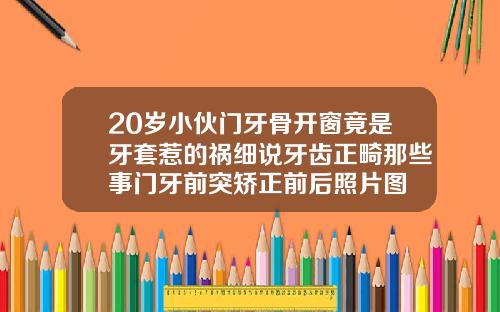20岁小伙门牙骨开窗竟是牙套惹的祸细说牙齿正畸那些事门牙前突矫正前后照片图