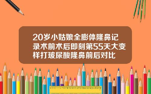 20岁小姑娘全膨体隆鼻记录术前术后即刻第55天大变样打玻尿酸隆鼻前后对比