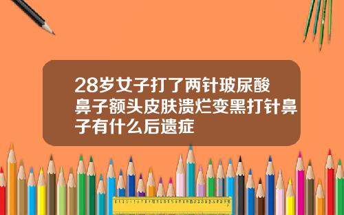 28岁女子打了两针玻尿酸鼻子额头皮肤溃烂变黑打针鼻子有什么后遗症