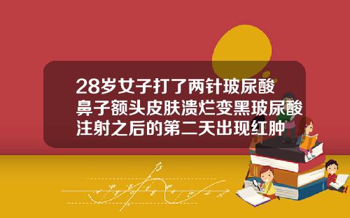 28岁女子打了两针玻尿酸鼻子额头皮肤溃烂变黑玻尿酸注射之后的第二天出现红肿