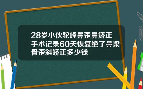 28岁小伙驼峰鼻歪鼻矫正手术记录60天恢复绝了鼻梁骨歪斜矫正多少钱