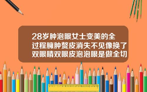 28岁肿泡眼女士变美的全过程臃肿赘皮消失不见像换了双眼睛双眼皮泡泡眼是做全切还是微创