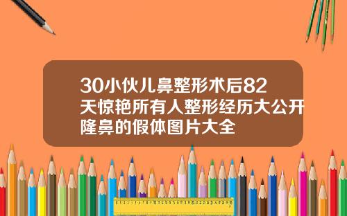 30小伙儿鼻整形术后82天惊艳所有人整形经历大公开隆鼻的假体图片大全