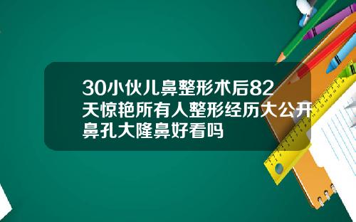 30小伙儿鼻整形术后82天惊艳所有人整形经历大公开鼻孔大隆鼻好看吗
