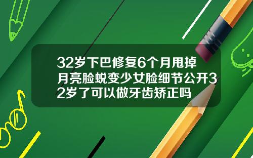 32岁下巴修复6个月甩掉月亮脸蜕变少女脸细节公开32岁了可以做牙齿矫正吗