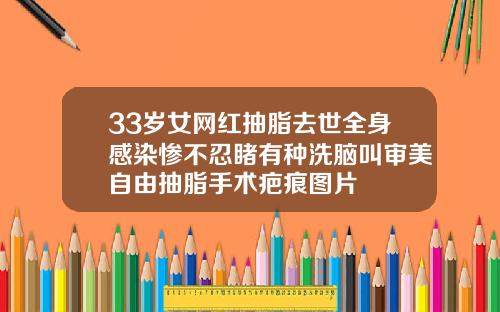 33岁女网红抽脂去世全身感染惨不忍睹有种洗脑叫审美自由抽脂手术疤痕图片