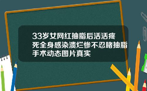 33岁女网红抽脂后活活疼死全身感染溃烂惨不忍睹抽脂手术动态图片真实