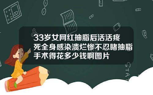 33岁女网红抽脂后活活疼死全身感染溃烂惨不忍睹抽脂手术得花多少钱啊图片