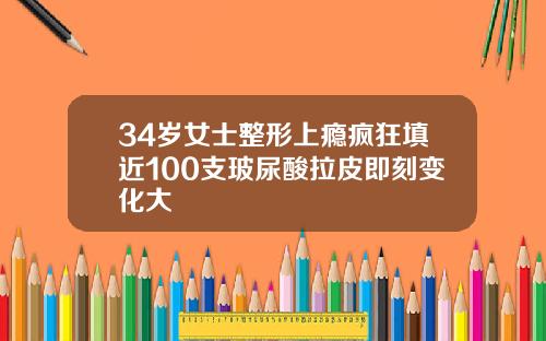 34岁女士整形上瘾疯狂填近100支玻尿酸拉皮即刻变化大