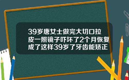 39岁唐女士做完大切口拉皮一照镜子吓坏了2个月恢复成了这样39岁了牙齿能矫正吗视频