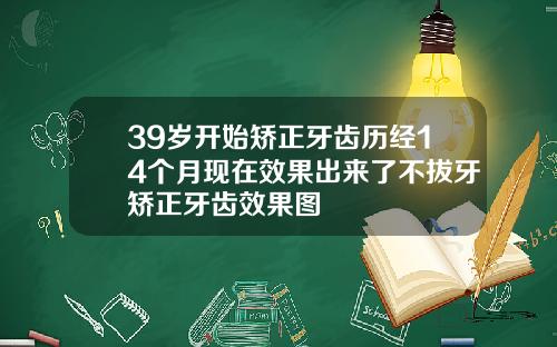 39岁开始矫正牙齿历经14个月现在效果出来了不拔牙矫正牙齿效果图