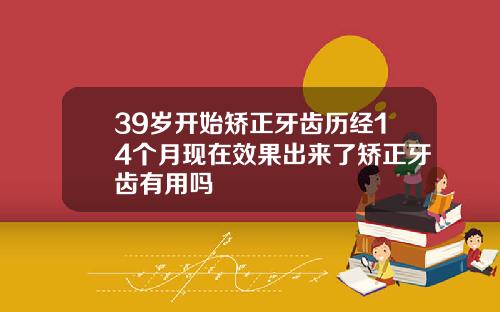 39岁开始矫正牙齿历经14个月现在效果出来了矫正牙齿有用吗