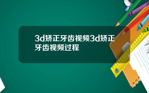 3d矫正牙齿视频3d矫正牙齿视频过程