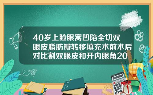 40岁上睑眼窝凹陷全切双眼皮脂肪瓣转移填充术前术后对比割双眼皮和开内眼角20天的图片区别
