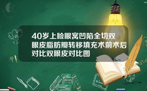 40岁上睑眼窝凹陷全切双眼皮脂肪瓣转移填充术前术后对比双眼皮对比图