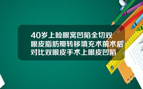 40岁上睑眼窝凹陷全切双眼皮脂肪瓣转移填充术前术后对比双眼皮手术上眼皮凹陷