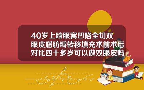 40岁上睑眼窝凹陷全切双眼皮脂肪瓣转移填充术前术后对比四十多岁可以做双眼皮吗图片