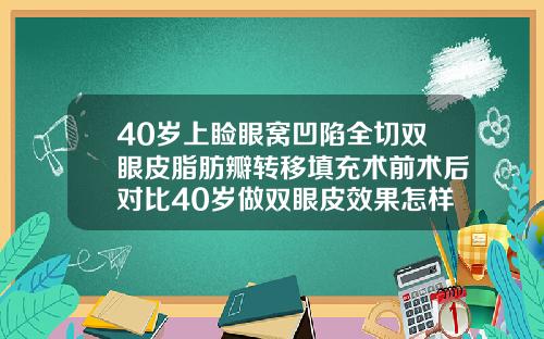 40岁上睑眼窝凹陷全切双眼皮脂肪瓣转移填充术前术后对比40岁做双眼皮效果怎样