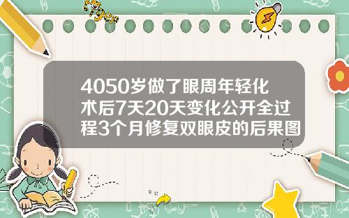 4050岁做了眼周年轻化术后7天20天变化公开全过程3个月修复双眼皮的后果图片