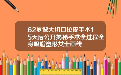 62岁做大切口拉皮手术15天后公开揭秘手术全过程全身吸脂塑形女士画线
