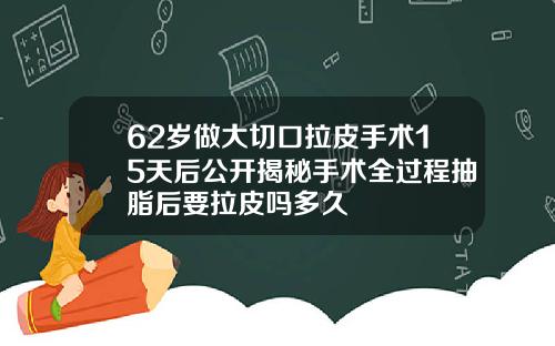 62岁做大切口拉皮手术15天后公开揭秘手术全过程抽脂后要拉皮吗多久