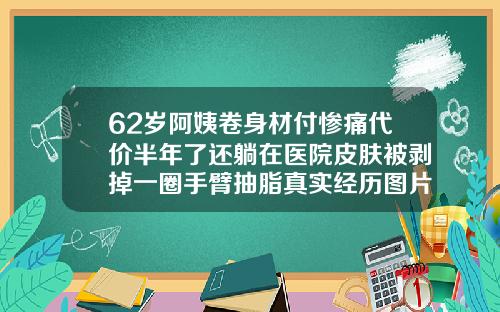 62岁阿姨卷身材付惨痛代价半年了还躺在医院皮肤被剥掉一圈手臂抽脂真实经历图片